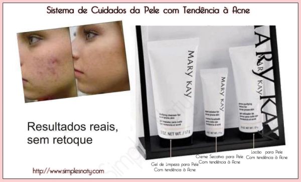 Kit para tendência a acne